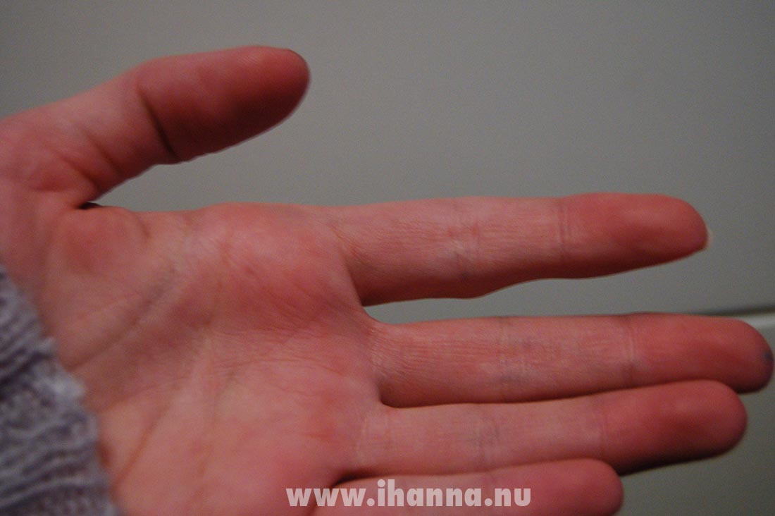 My empty hand (copyright Hanna Andersson)
